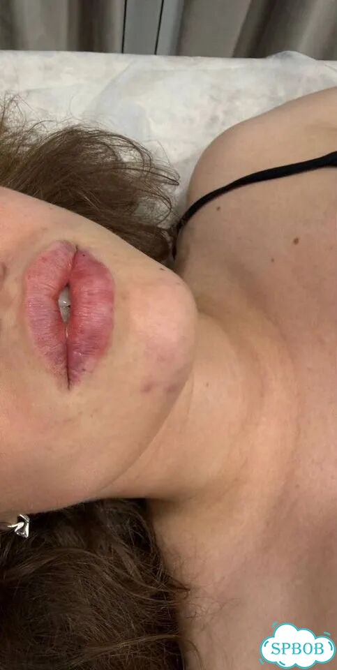Красивые губы без боли Увеличение и коррекция фото 2