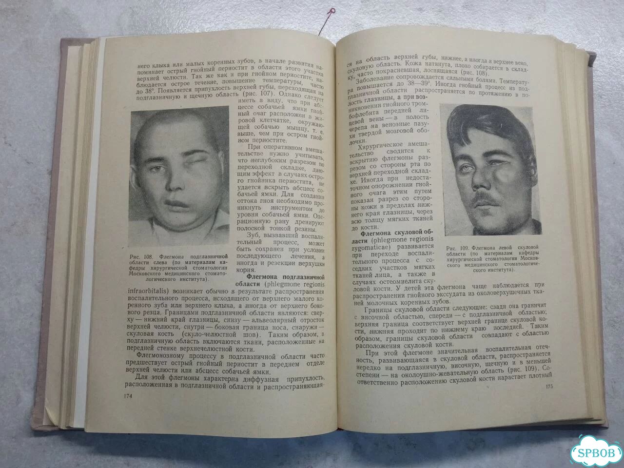 Хирургия зубов и полости рта 1957 год фото 7